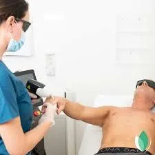 Depilación definitiva: tecnología, protocolo y rentabilidad clínica